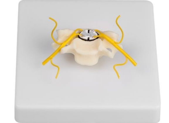 https://www.jayakelana.co.id/uploads/product/-4067-vertebra-with-spinal-952539f2afe432b_cover.jpg