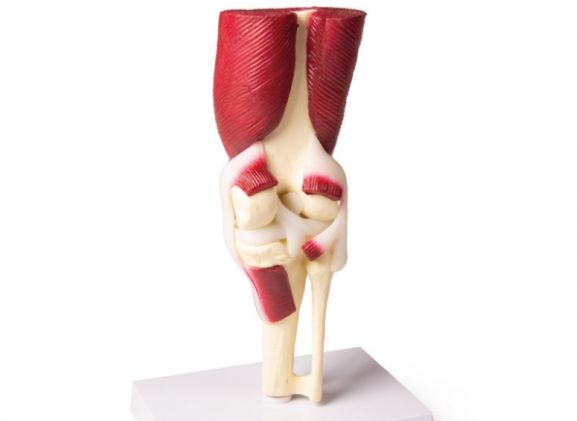 https://www.jayakelana.co.id/uploads/product/-4662-knee-joint-life-8299968e157feef_cover.jpg