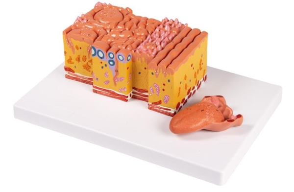 (C166) Tongue and Tongue Tissue