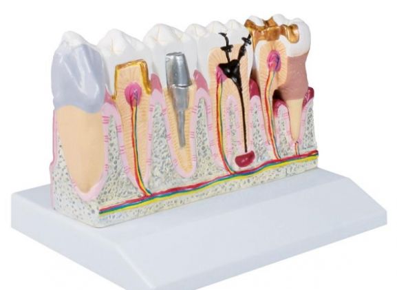 https://www.jayakelana.co.id/uploads/product/-d250-dental-model-4-74088418ba20bdb_cover.jpg