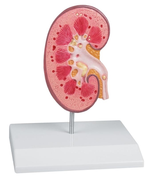 (K229) Kidney Stone Model - EZ Augmented Anatomy