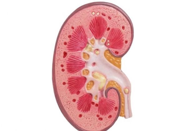 https://www.jayakelana.co.id/uploads/product/-k229-kidney-stone-model-18398e383d2b92e_cover.jpg