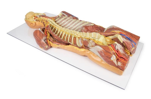 (MP1410) Posterior Body Wall / Ventral Deep Dissection