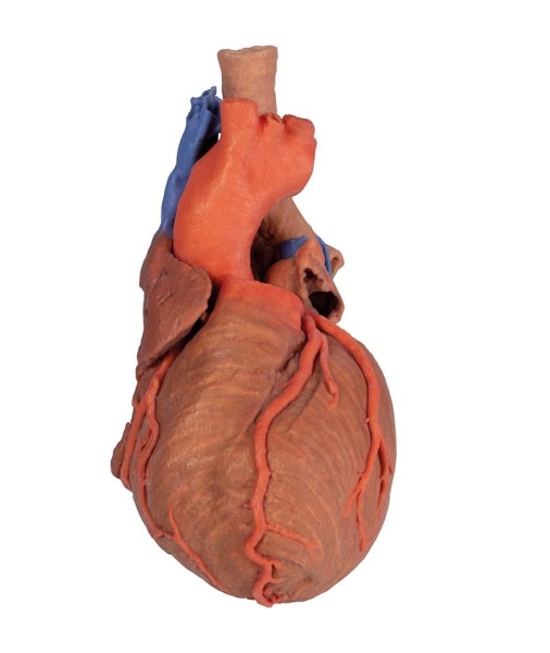 (MP1710) Heart and The Distal Trachea, Carina and Primary Bronchi