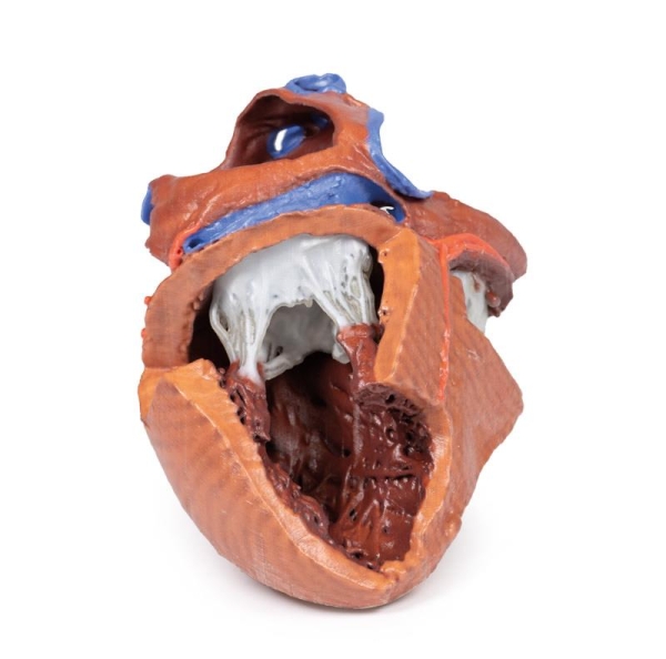 (MP1715) Heart Internal Structures