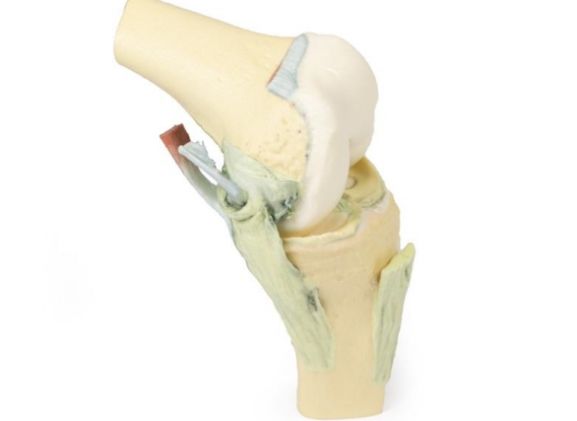 https://www.jayakelana.co.id/uploads/product/-mp1800-knee-joint-flexed-89418a7b40730c5_cover.jpg