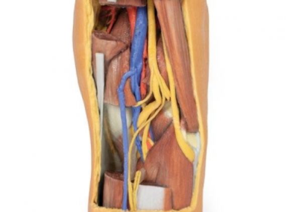 https://www.jayakelana.co.id/uploads/product/-mp1820-popliteal-fossa-distal-7454066ff46504e_cover.jpg