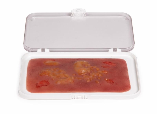 (NW007) Wound Moulage 2nd Degree Burn