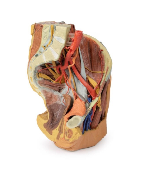 (MP1780) Female Left Pelvis and Proximal Thigh