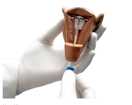 (S507) UTERUS I IUD PLACEMENT MODEL 
